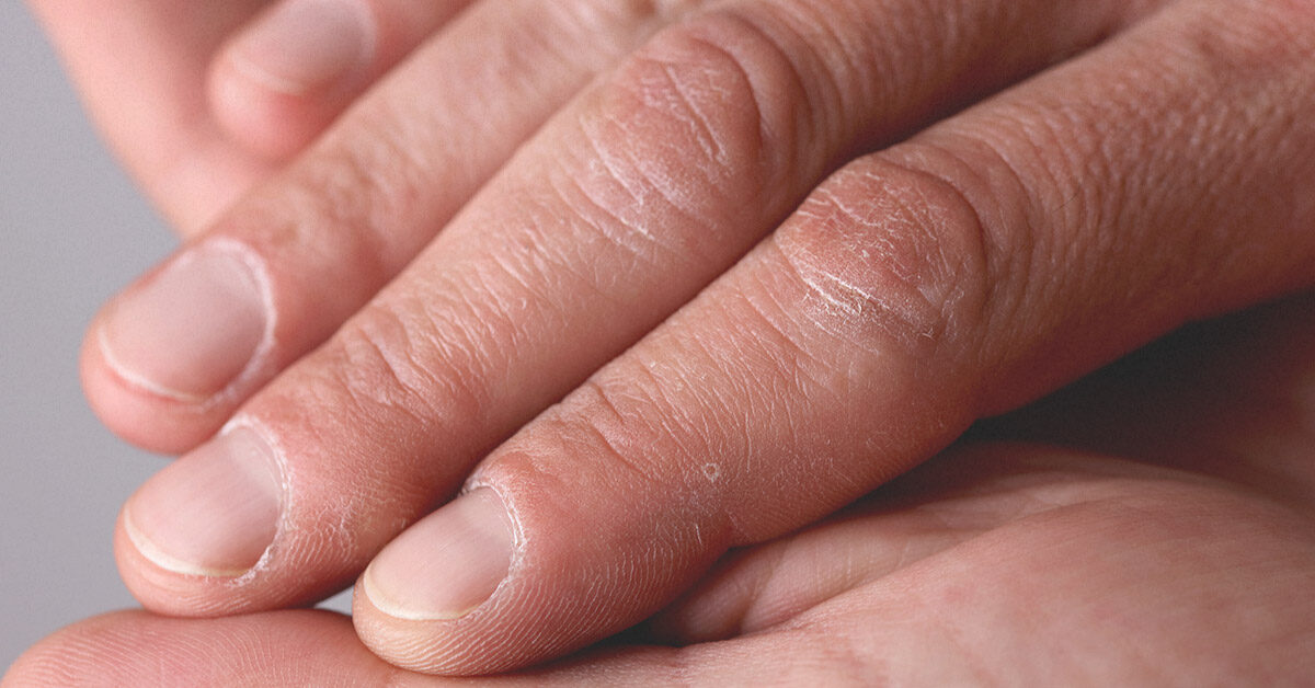આંગળીમાં દેખાતો અર્ધચંદ્ર આરોગ્યની આપે છે જાણકારી, શું તમારી આંગળીમાં છે અર્ધચંદ્ર?
