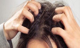 વાળની દુર્ગંઘ અને તેમાં થતા પરસેવાની સમસ્યાનું આવી શકે છે નિરાકરણ, અપનાવો આ ટિપ્સ