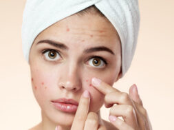 Acne spot pimple spot skincare beauty care girl pressing on skin