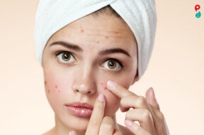 Acne spot pimple spot skincare beauty care girl pressing on skin