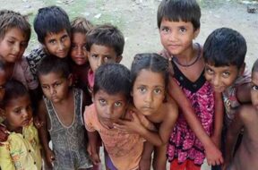 malnourished children-1