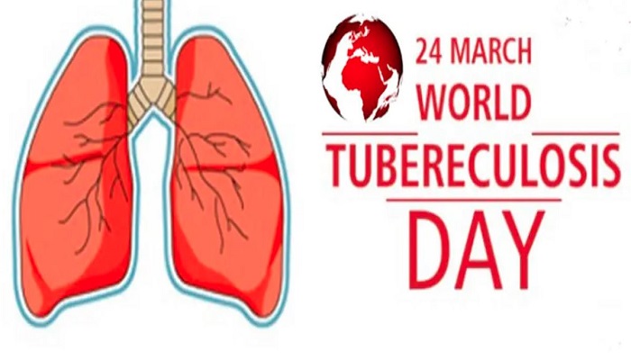 આજે TB દિવસઃ ગુજરાતમાં દર વર્ષે 1.70 લાખ કેસ અને 1000 દર્દીના મોતને ભેટે છે