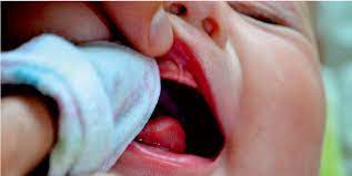 નાના બાળકોને જ્યારે દાંત આવે ત્યારે પેઢામાં ખંજવાળ આવે છે,આવા સમયે અપનાવો આ નુસ્ખાઓ