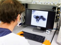2022-05-24t144940z487985953rc2odu9hwwjdrtrmadp3health-monkeypox-germany-vaccine-1112137-1653406756