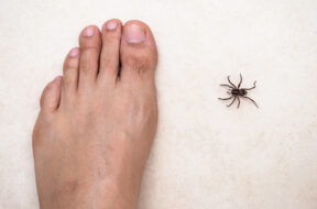 home-remedies-to-heal-spider-bites-feat