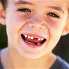 શા માટે બાળકોના દૂધના દાંત તુટી જાય છે? આજે જ જાણો