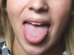 tongue_5dfa11ff10c39