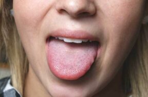 tongue_5dfa11ff10c39