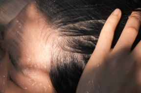 scalp-treatment-644a59123eeb2