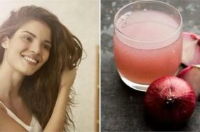 2023_10image_12_00_183304384onion_juice_for_hair_l-ll