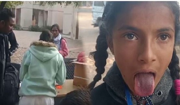 ધાનેરાના મોટી ડુંગડોલ ગામની શાળામાં મધ્યાહન ભોજન બાદ 50 બાળકોની જીભ કાળી પડી ગઈ,