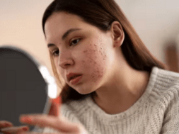 skin care