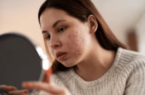 skin care