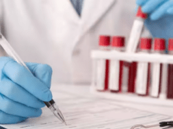 blood test