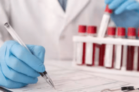 blood test