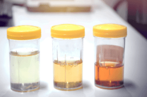 urine