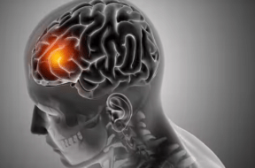 brain