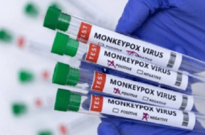 monkeypox
