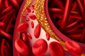 blood