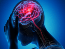 brain
