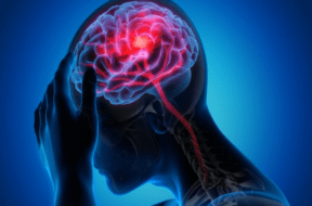 brain