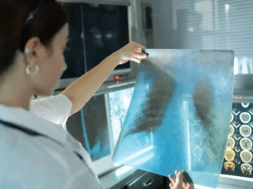 x ray macine