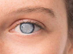eye