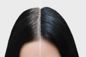hair