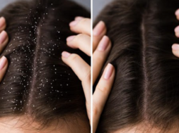 hair