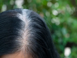 wite hair
