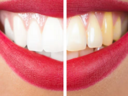 teeth