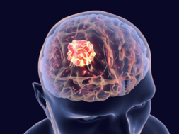 brain
