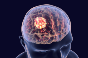 brain