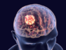 brain