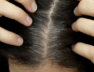 hair