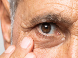 EYE