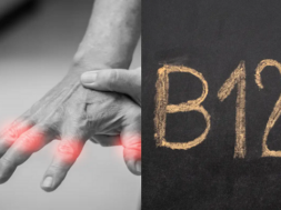 b12