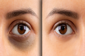eye