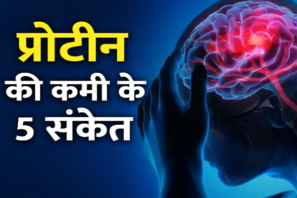 શરીરમાં આ 5 પ્રકારના લક્ષણો દેખાય, તો સમજો કે શરીરમાં ઘટી રહ્યું છે પ્રોટીન