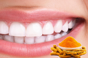 teeth