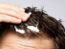 HAIR