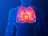 hart atteck