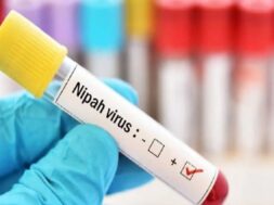 nipah virus