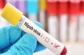 nipah virus