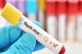 nipah virus