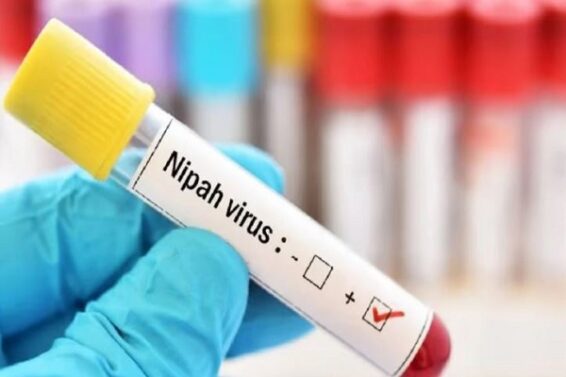 nipah virus