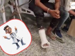 doctor plastered everything except the injured area